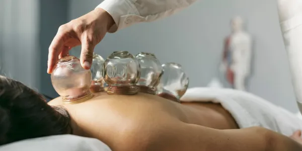 how can Cupping Support Your Treatment